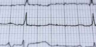 Scossa di terremoto registrata nel golfo di Napoli