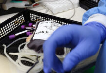 Trasfusione di sangue a una Testimone di Geova, medici assolti