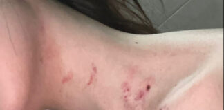 Ragazza napoletana picchiata e strangolata al Nord dal fidanzato