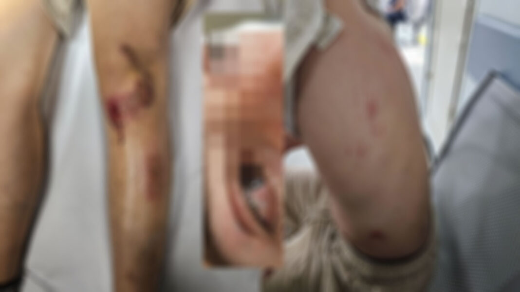 aggressione copertina